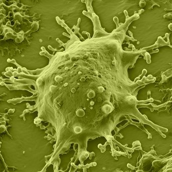 Mycoplasma_AI_1_green.png