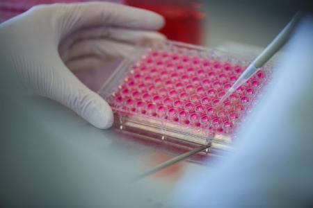 Für eine bessere Krankheitsdiagnostik: Im Projekt „DiagNeeds“ haben der BioLAGO e.V. und die BIOPRO Baden-Württemberg GmbH den Bedarf an neuen Diagnosemethoden von Kliniken erfasst und diese mit Firmen und Forschung vernetzt. © trenzyme GmbH