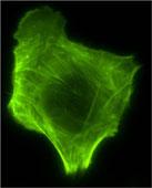 A549 cell, transduced with rAVCMV-LifeAct-TagGFP2 (green) - courtesy of ibidi
