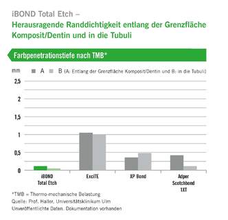 iBond Total Etch Diagramm