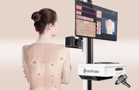 Der FotoFinder bodystudio ATBM master verbindet Ganzkörperkartografie mit digitaler Dermatoskopie für eine bestmögliche Hautkrebsvorsorge ©2020 FotoFinder Systems GmbH