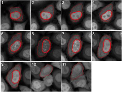 Cell Cycle Chromobody® signal during the cell cycle. In G1 the Chromobody® signal is homogeneously distributed throughout the nucleus and cytoplasm. During S phase it accumulates in the nucleus and visualizes the formation of replication foci. In G2 the