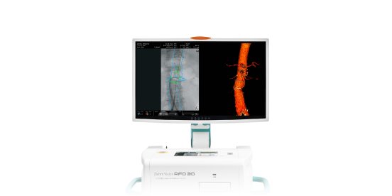 EndovascularNavigation_Monitor.jpg