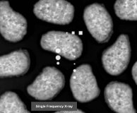 X-Ray, Röntgentechnologie, optischen Inspektionslösungen