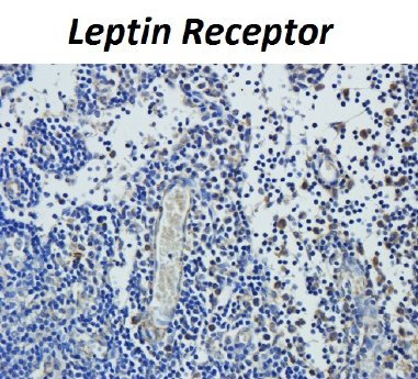 Leptin Receptor Market.jpg
