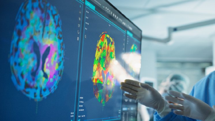 iStock-2191191052_Schädelbasistag_02_72dpi-bdf10e2a (1).png