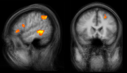 aktivierte Hirnregionen(c)LIN.jpg