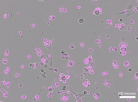 Cas12a2-induced_cell_death_c_Liu_Lab_University_of_Utah_Health_01.jpg