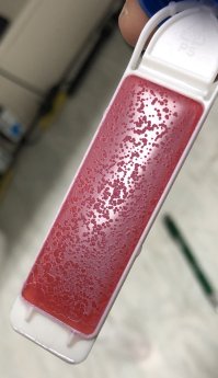 Produktionshygiene_für_ETL-_AnlagenDipSlide_Hefe_02.JPG