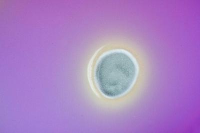 Textile Materialien können in Verbindung mit Feuchtigkeit einen idealen Nährboden für Schimmelpilze und Bakterien darstellen. © Hohenstein Institute
