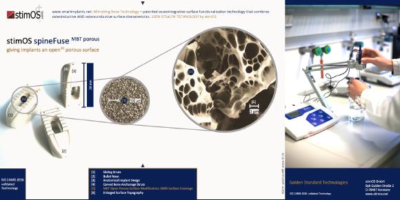 stimOS spineFuse MBT implant family