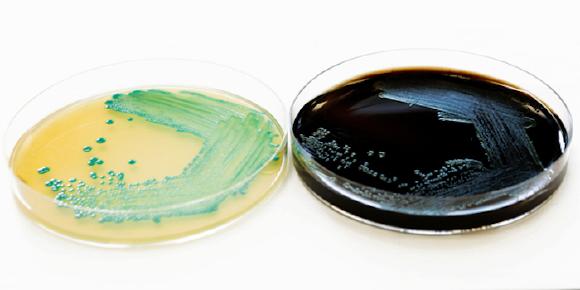 Schnellmethode Listeria